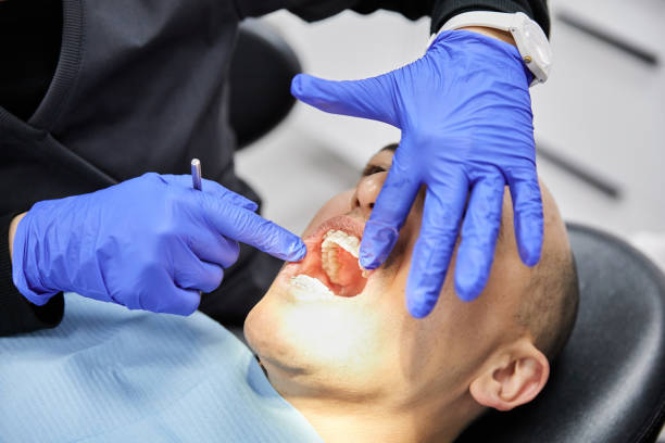 Best Emergency Wisdom Teeth Removal in Oakley, CA